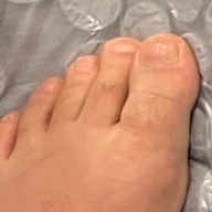 Kod adı ork ayağı